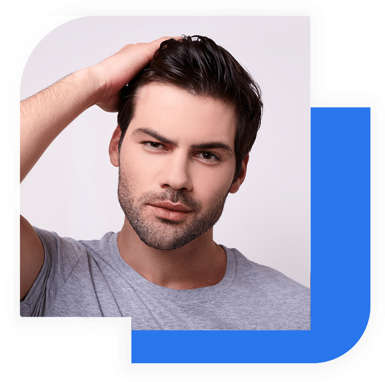 Greffe de cheveux en Turquie - Image